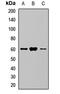 Solute Carrier Family 5 Member 1 antibody, LS-C668024, Lifespan Biosciences, Western Blot image 