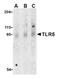 Toll Like Receptor 5 antibody, AP05235PU-N, Origene, Western Blot image 
