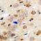 Gamma-Aminobutyric Acid Type A Receptor Gamma1 Subunit antibody, LS-C368899, Lifespan Biosciences, Immunohistochemistry paraffin image 