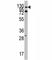 ABL Proto-Oncogene 1, Non-Receptor Tyrosine Kinase antibody, F50695-0.4ML, NSJ Bioreagents, Western Blot image 