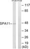 Serpin Family A Member 11 antibody, A17849, Boster Biological Technology, Western Blot image 