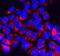 Transient Receptor Potential Cation Channel Subfamily M Member 7 antibody, NBP1-20224, Novus Biologicals, Immunofluorescence image 