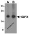 HOP Homeobox antibody, 8143, ProSci, Western Blot image 