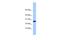 Refilin A antibody, A14964, Boster Biological Technology, Western Blot image 