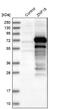 Zinc Finger Protein 18 antibody, NBP1-81758, Novus Biologicals, Western Blot image 