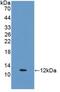 Estrogen Receptor 2 antibody, MBS2003377, MyBioSource, Western Blot image 