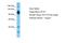 ATPase Na+/K+ Transporting Subunit Alpha 1 antibody, A30027, Boster Biological Technology, Western Blot image 