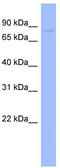 Glycerol-3-Phosphate Dehydrogenase 2 antibody, TA335231, Origene, Western Blot image 