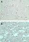 Formin Like 2 antibody, PA5-23194, Invitrogen Antibodies, Immunohistochemistry paraffin image 