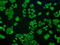 Crystallin Alpha B antibody, GTX84659, GeneTex, Immunofluorescence image 
