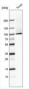 Transglutaminase 1 antibody, NBP2-34062, Novus Biologicals, Western Blot image 