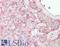 Insulin Receptor antibody, LS-B10207, Lifespan Biosciences, Immunohistochemistry frozen image 