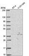 NSL1 Component Of MIS12 Kinetochore Complex antibody, PA5-65817, Invitrogen Antibodies, Western Blot image 