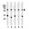Pyruvate Kinase M1/2 antibody, F40140-0.4ML, NSJ Bioreagents, Western Blot image 
