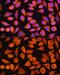 Keratin 5 antibody, GTX33140, GeneTex, Immunocytochemistry image 