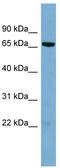 Heterochromatin Protein 1 Binding Protein 3 antibody, TA345042, Origene, Western Blot image 