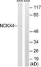 Solute Carrier Family 24 Member 4 antibody, TA316067, Origene, Western Blot image 