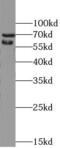 SCH antibody, FNab05685, FineTest, Western Blot image 