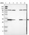 Cytochrome B5 Reductase 1 antibody, NBP1-83144, Novus Biologicals, Western Blot image 