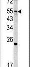 Glucosamine (N-Acetyl)-6-Sulfatase antibody, PA5-13517, Invitrogen Antibodies, Western Blot image 
