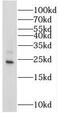 Stathmin 3 antibody, FNab08341, FineTest, Western Blot image 