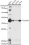 Chloride Nucleotide-Sensitive Channel 1A antibody, A06086-1, Boster Biological Technology, Western Blot image 