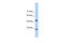 Aryl Hydrocarbon Receptor Interacting Protein antibody, 28-333, ProSci, Western Blot image 