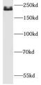 Dedicator Of Cytokinesis 8 antibody, FNab02498, FineTest, Western Blot image 