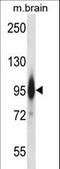 Protein Kinase C Epsilon antibody, LS-C164549, Lifespan Biosciences, Western Blot image 