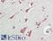 RCC1 And BTB Domain Containing Protein 1 antibody, LS-B13631, Lifespan Biosciences, Immunohistochemistry paraffin image 