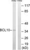 BCL10 Immune Signaling Adaptor antibody, LS-B12522, Lifespan Biosciences, Western Blot image 