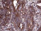 Protein transport protein Sec23B antibody, M05847, Boster Biological Technology, Immunohistochemistry paraffin image 