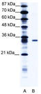 Potassium Voltage-Gated Channel Interacting Protein 4 antibody, TA337257, Origene, Western Blot image 