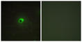 Activin A Receptor Type 1C antibody, abx013700, Abbexa, Western Blot image 