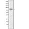 Zinc Finger Protein 600 antibody, PA5-67677, Invitrogen Antibodies, Western Blot image 