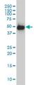 SMU1 DNA Replication Regulator And Spliceosomal Factor antibody, H00055234-M01, Novus Biologicals, Western Blot image 