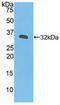 Janus Kinase 3 antibody, MBS2005526, MyBioSource, Western Blot image 