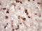 RB Transcriptional Corepressor 1 antibody, LS-C339681, Lifespan Biosciences, Immunohistochemistry paraffin image 