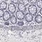 Tectonin Beta-Propeller Repeat Containing 2 antibody, PA5-51435, Invitrogen Antibodies, Immunohistochemistry frozen image 