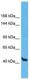 WD Repeat Domain 59 antibody, TA330823, Origene, Western Blot image 