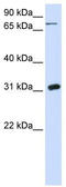 Uridine Phosphorylase 1 antibody, TA346355, Origene, Western Blot image 