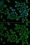 Tryptophanyl-TRNA Synthetase antibody, GTX32939, GeneTex, Immunocytochemistry image 