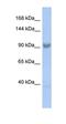 Spliceosome Associated Factor 3, U4/U6 Recycling Protein antibody, orb329773, Biorbyt, Western Blot image 
