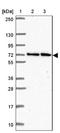 CBFA2/RUNX1 Partner Transcriptional Co-Repressor 2 antibody, NBP2-34136, Novus Biologicals, Western Blot image 
