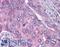 Polo Like Kinase 1 antibody, LS-B50, Lifespan Biosciences, Immunohistochemistry paraffin image 