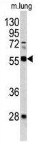 Fli-1 Proto-Oncogene, ETS Transcription Factor antibody, GTX81878, GeneTex, Western Blot image 