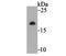 NADH:Ubiquinone Oxidoreductase Subunit S4 antibody, NBP2-76885, Novus Biologicals, Western Blot image 