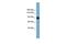 Apoptosis Resistant E3 Ubiquitin Protein Ligase 1 antibody, GTX46608, GeneTex, Western Blot image 