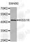 KISS1 Receptor antibody, A2967, ABclonal Technology, Western Blot image 