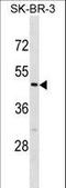 Calsequestrin 2 antibody, LS-C157601, Lifespan Biosciences, Western Blot image 